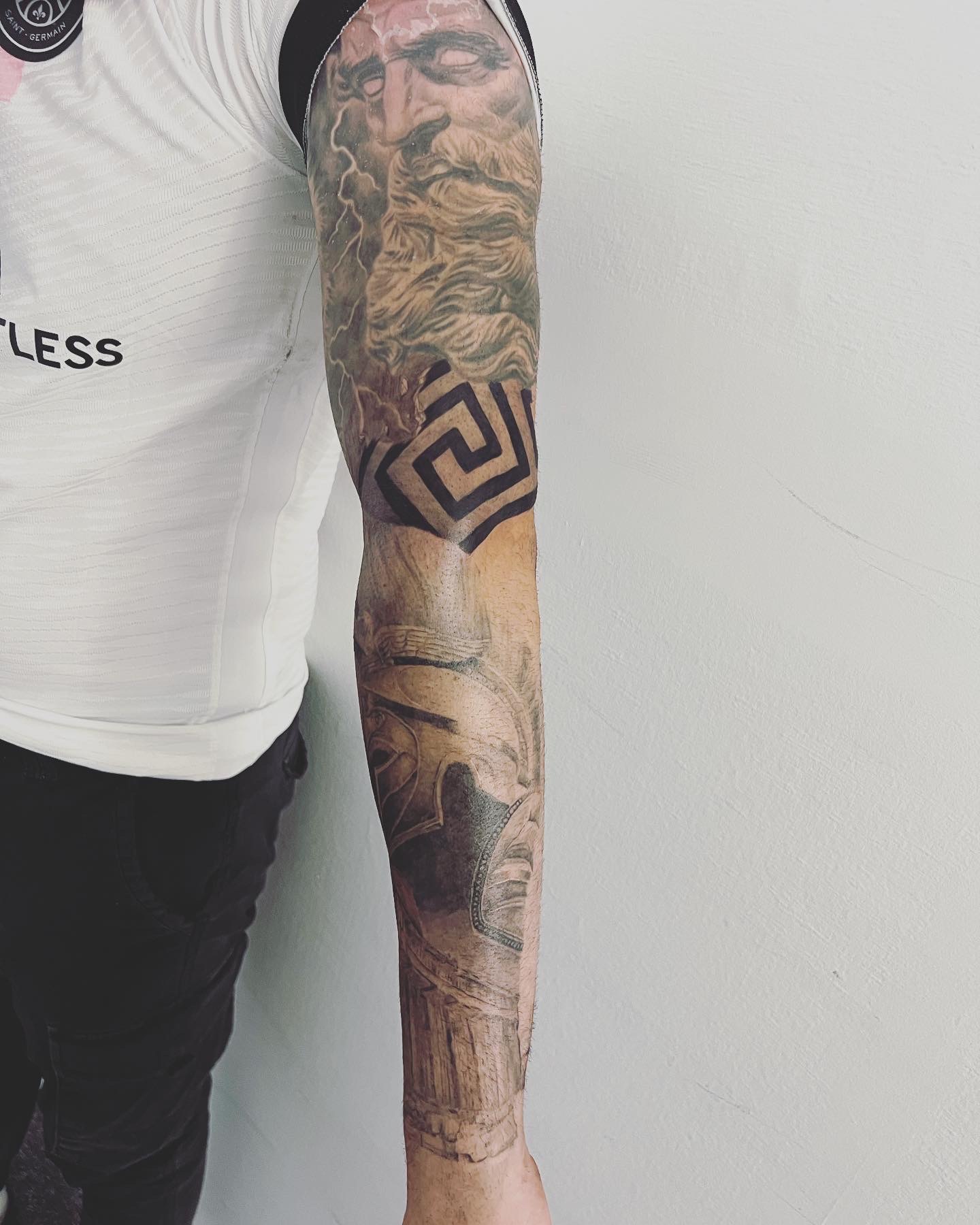 Arm